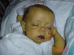 beforesurgery.jpg